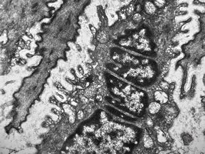 contracted smooth muscle cells in an intestinal villus